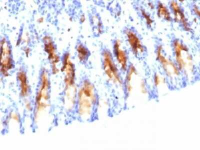 Immunohistochemistry-Paraffin: MUC5AC Antibody (45M1) - Azide and BSA Free [NBP2-32732]