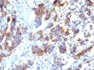 Immunohistochemistry-Paraffin: MUC5AC Antibody (45M1) - IHC-Prediluted [NBP2-44450]