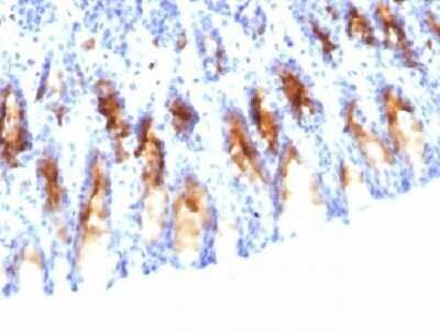 Immunohistochemistry-Paraffin: MUC5AC Antibody (45M1) - IHC-Prediluted [NBP2-44450]