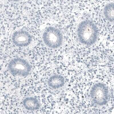Immunohistochemistry-Paraffin: MUC5AC Antibody (CL8961) [NBP2-88920]