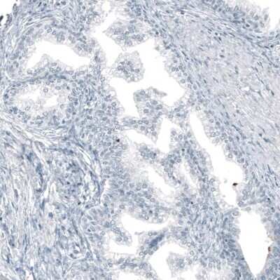 Immunohistochemistry-Paraffin: MUC5AC Antibody (CL8961) [NBP2-88920]