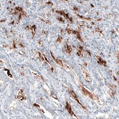 Immunohistochemistry-Paraffin: MUC5AC Antibody (CL8961) [NBP2-88920]
