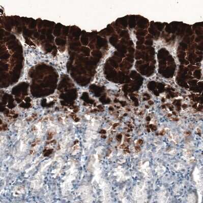 Immunohistochemistry-Paraffin: MUC5AC Antibody (CL8961) [NBP2-88920]