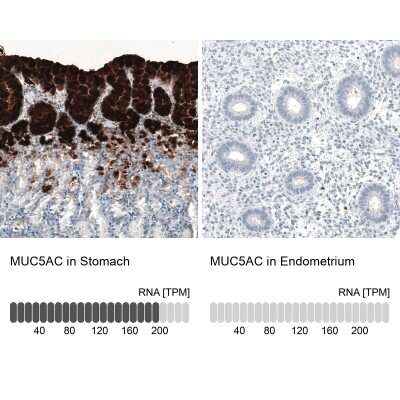 Immunohistochemistry-Paraffin: MUC5AC Antibody (CL8961) [NBP2-88920]