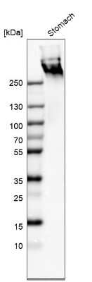 Western Blot: MUC5AC Antibody (CL8961) [NBP2-88920]
