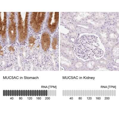 Immunohistochemistry-Paraffin: MUC5AC Antibody [NBP2-31986]