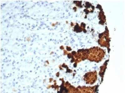 Immunohistochemistry-Paraffin: MUC5AC Antibody (MUC5AC/7067R) [NBP3-13975]