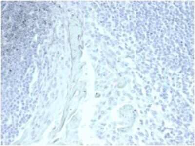 Immunohistochemistry-Paraffin: MUC5AC Antibody (MUC5AC/7067R) [NBP3-13975]