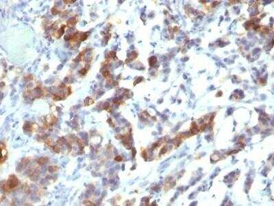 Immunohistochemistry-Paraffin: MUC5AC Antibody (MUC5AC/917 + 45M1) - Azide and BSA Free [NBP2-47696]