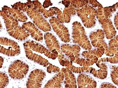 Immunohistochemistry-Paraffin: MUC5AC Antibody (MUC5AC/917 + 45M1) - Azide and BSA Free [NBP2-47696]