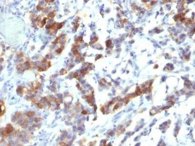 Immunohistochemistry-Paraffin: MUC5AC Antibody (MUC5AC/917 + 45M1) - IHC-Prediluted [NBP2-48429]