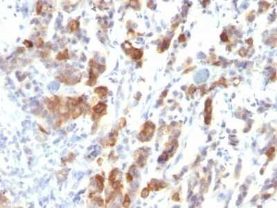 Immunohistochemistry-Paraffin: MUC5AC Antibody (MUC5AC/917) - IHC-Prediluted [NBP2-48428]