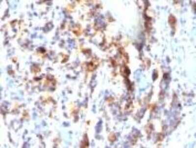 Immunohistochemistry-Paraffin: MUC5AC Antibody (SPM297) - Azide and BSA Free [NBP2-34758]