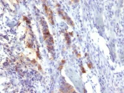 Immunohistochemistry-Paraffin: MUC5AC Antibody (SPM488) - IHC-Prediluted [NBP2-48427]