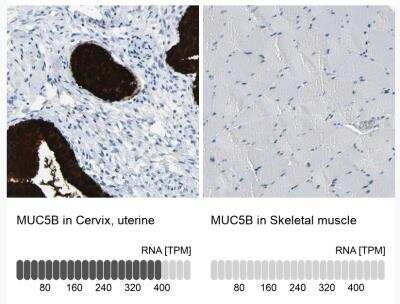 Immunohistochemistry-Paraffin: MUC5B Antibody [NBP1-92151]