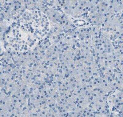 Immunohistochemistry-Paraffin: MUC5B Antibody [NBP1-92151]