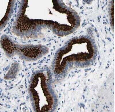 Immunohistochemistry-Paraffin: MUC5B Antibody [NBP1-92151]