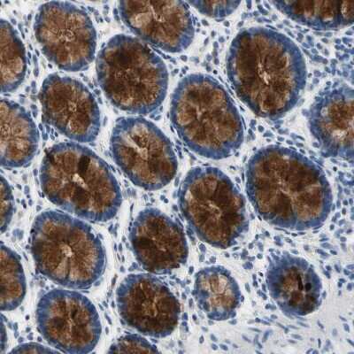Immunohistochemistry-Paraffin: MUC5B Antibody [NBP1-92151]