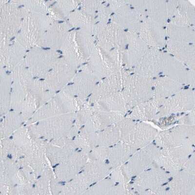 Immunohistochemistry-Paraffin: MUC5B Antibody [NBP1-92151]