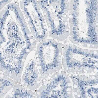 Immunohistochemistry-Paraffin: MUC7 Antibody [NBP1-82045]