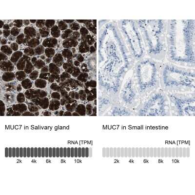 Immunohistochemistry-Paraffin: MUC7 Antibody [NBP1-82045]