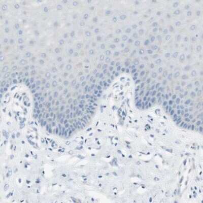 Immunohistochemistry-Paraffin: MUCDHL Antibody [NBP1-92148]