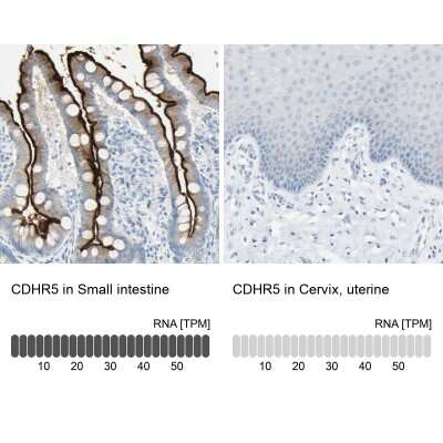 Immunohistochemistry-Paraffin: MUCDHL Antibody [NBP1-92148]