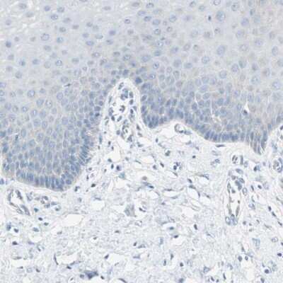Immunohistochemistry-Paraffin: MUCDHL Antibody [NBP1-92149]