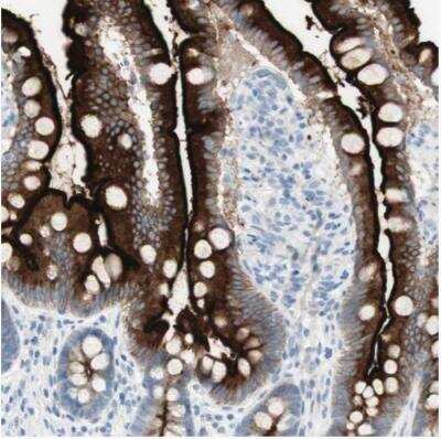 Immunohistochemistry-Paraffin: MUCDHL Antibody [NBP1-92149]