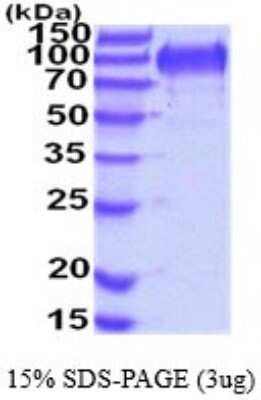 SDS-PAGE: Recombinant Mouse MUCDHL His Protein [NBP2-52285]