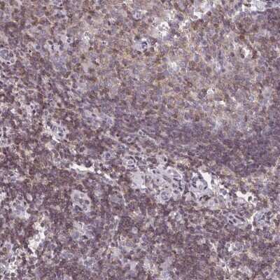 Immunohistochemistry: MUDENG Antibody [NBP2-33815]