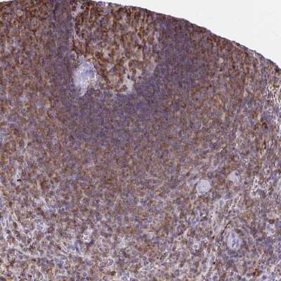 Immunohistochemistry-Paraffin: MUDENG Antibody [NBP2-33765]