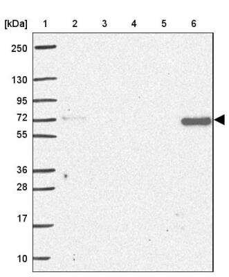 Western Blot: MUDENG Antibody [NBP2-33765]