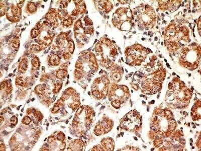 Immunohistochemistry: MUL1 Antibody (3G2.2F7) - Azide and BSA Free [NBP2-80861]
