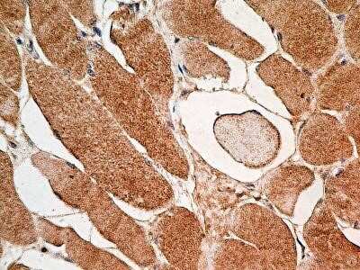 Immunohistochemistry: MUL1 Antibody (3G2.2F7) - Azide and BSA Free [NBP2-80861]