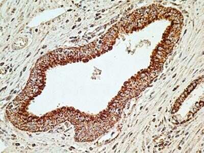 Immunohistochemistry: MUL1 Antibody (5H6.2D5) - Azide and BSA Free [NBP2-80860]