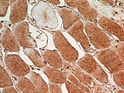 Immunohistochemistry: MUL1 Antibody (5H6.2D5) - Azide and BSA Free [NBP2-80860]
