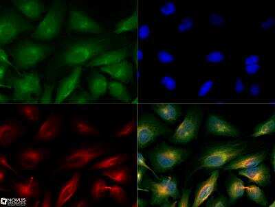 Immunocytochemistry/ Immunofluorescence: MUL1 Antibody [NBP2-31363]
