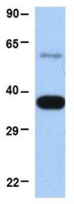 Western Blot: MUL1 Antibody [NBP1-59068]