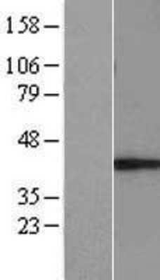 Western Blot: MUL1 Overexpression Lysate [NBL1-13394]