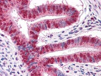 Immunohistochemistry: MUM1 Antibody (4G10) - BSA Free [NBP1-47396]