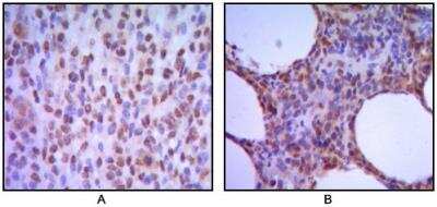 Immunohistochemistry: MUM1 Antibody (4G10) - BSA Free [NBP1-47396]