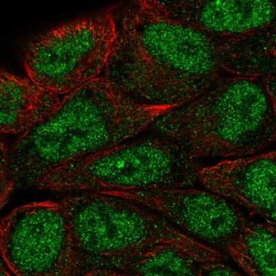 Immunocytochemistry/ Immunofluorescence: MUM1 Antibody [NBP2-13627]