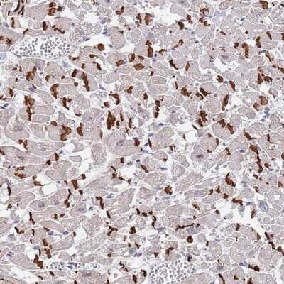 Immunohistochemistry-Paraffin: MUM1 Antibody [NBP2-13627]