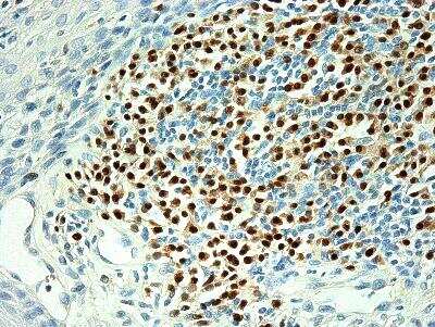 Immunohistochemistry-Paraffin: MUM1 Antibody (MUM1p) [NB200-356]