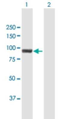 Western Blot: MUM1 Antibody [H00084939-B01P]