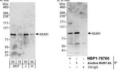 Western Blot: MUM1 Antibody [NBP1-78760]