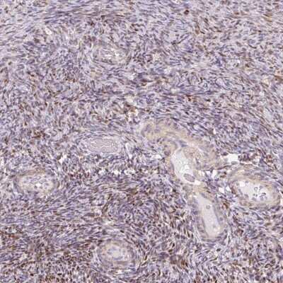 Immunohistochemistry-Paraffin: MUM1L1 Antibody [NBP1-81979]