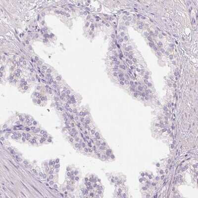 Immunohistochemistry-Paraffin: MUM1L1 Antibody [NBP1-81979]