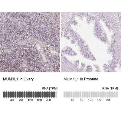 Immunohistochemistry-Paraffin: MUM1L1 Antibody [NBP1-81979]